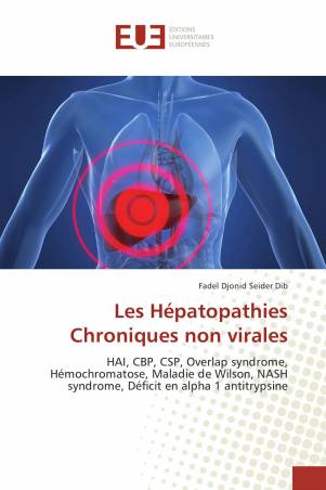 Les Hépatopathies Chroniques non virales