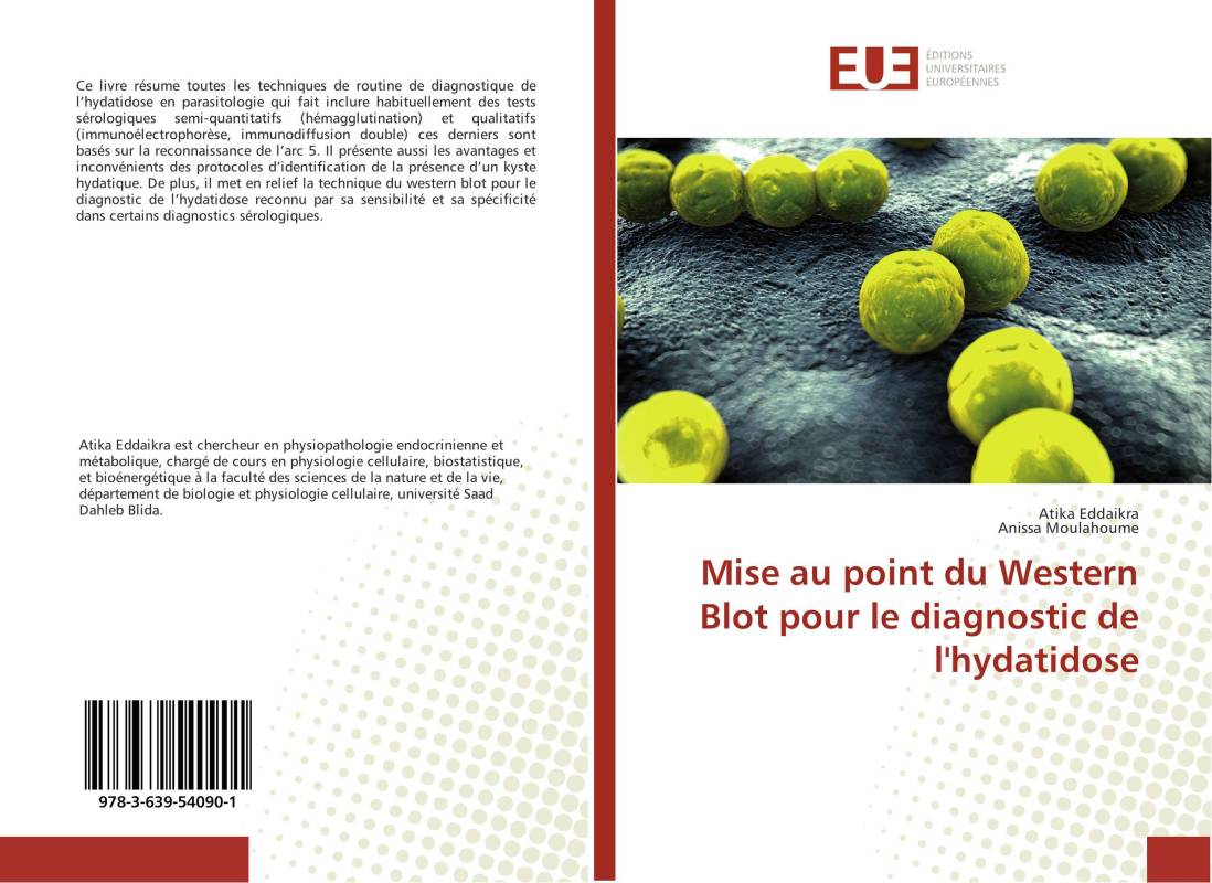 Mise au point du Western Blot pour le diagnostic de l'hydatidose