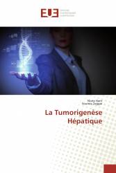 La Tumorigenèse Hépatique