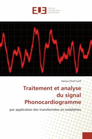 Traitement et analyse du signal Phonocardiogramme