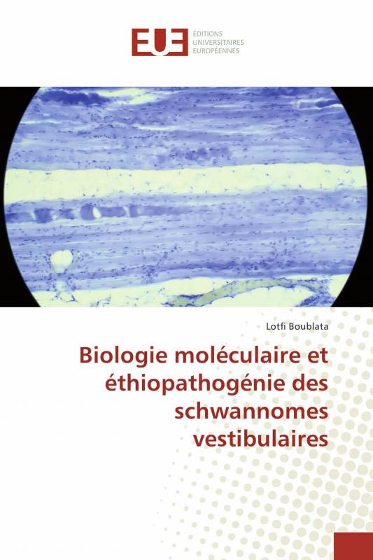 Biologie moléculaire et éthiopathogénie des schwannomes vestibulaires
