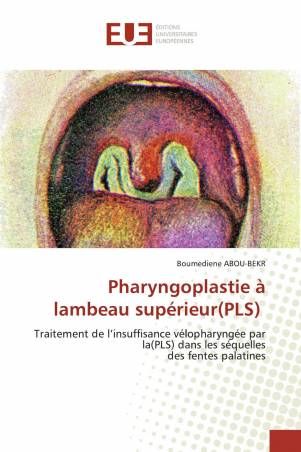 Pharyngoplastie à lambeau supérieur(PLS)