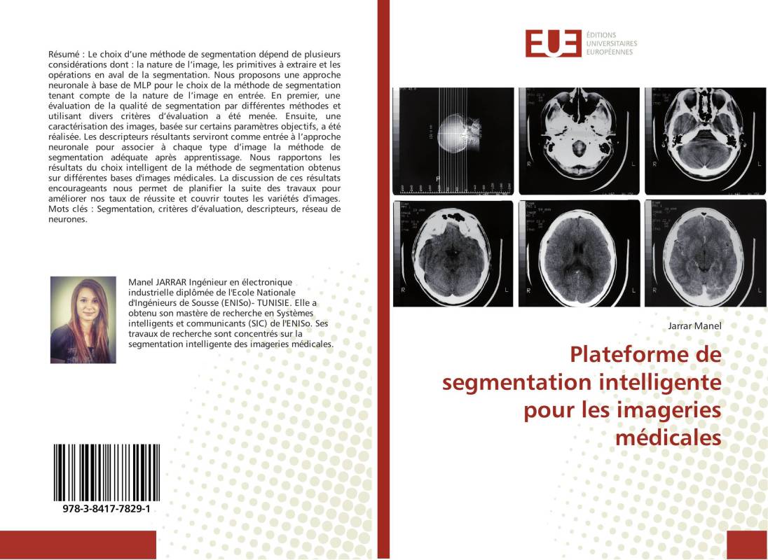 Plateforme de segmentation intelligente pour les imageries médicales