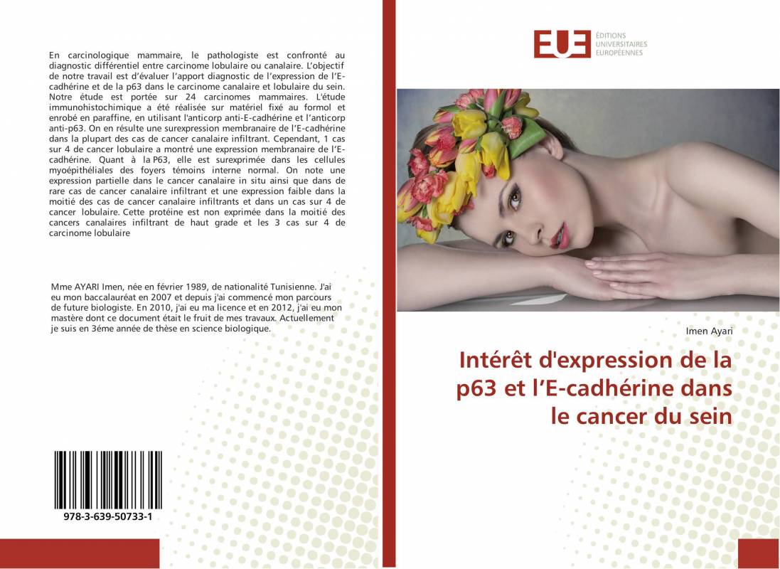 Intérêt d'expression de la p63 et l’E-cadhérine dans le cancer du sein