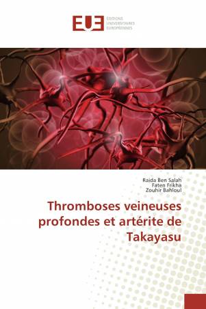 Thromboses veineuses profondes et artérite de Takayasu