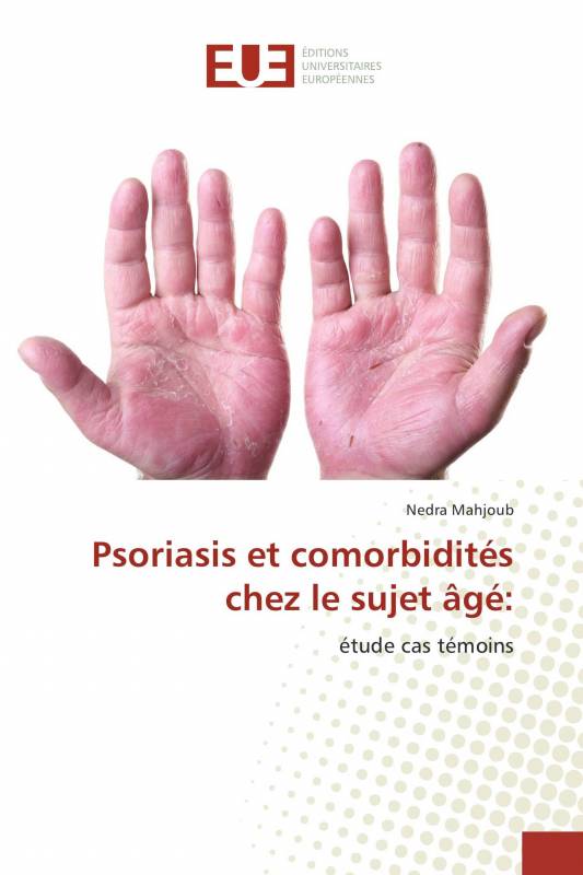 Psoriasis et comorbidités chez le sujet âgé: