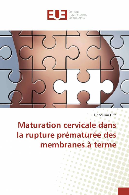 Maturation cervicale dans la rupture prématurée des membranes à terme