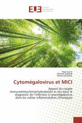 Cytomégalovirus et MICI