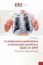 La tuberculose pulmonaire à microscopie positive à Opala en 2009