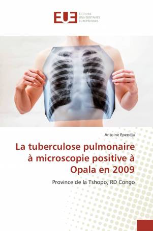 La tuberculose pulmonaire à microscopie positive à Opala en 2009