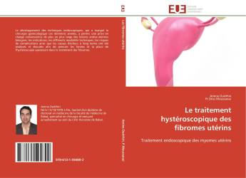 Le traitement hystéroscopique des fibromes utérins