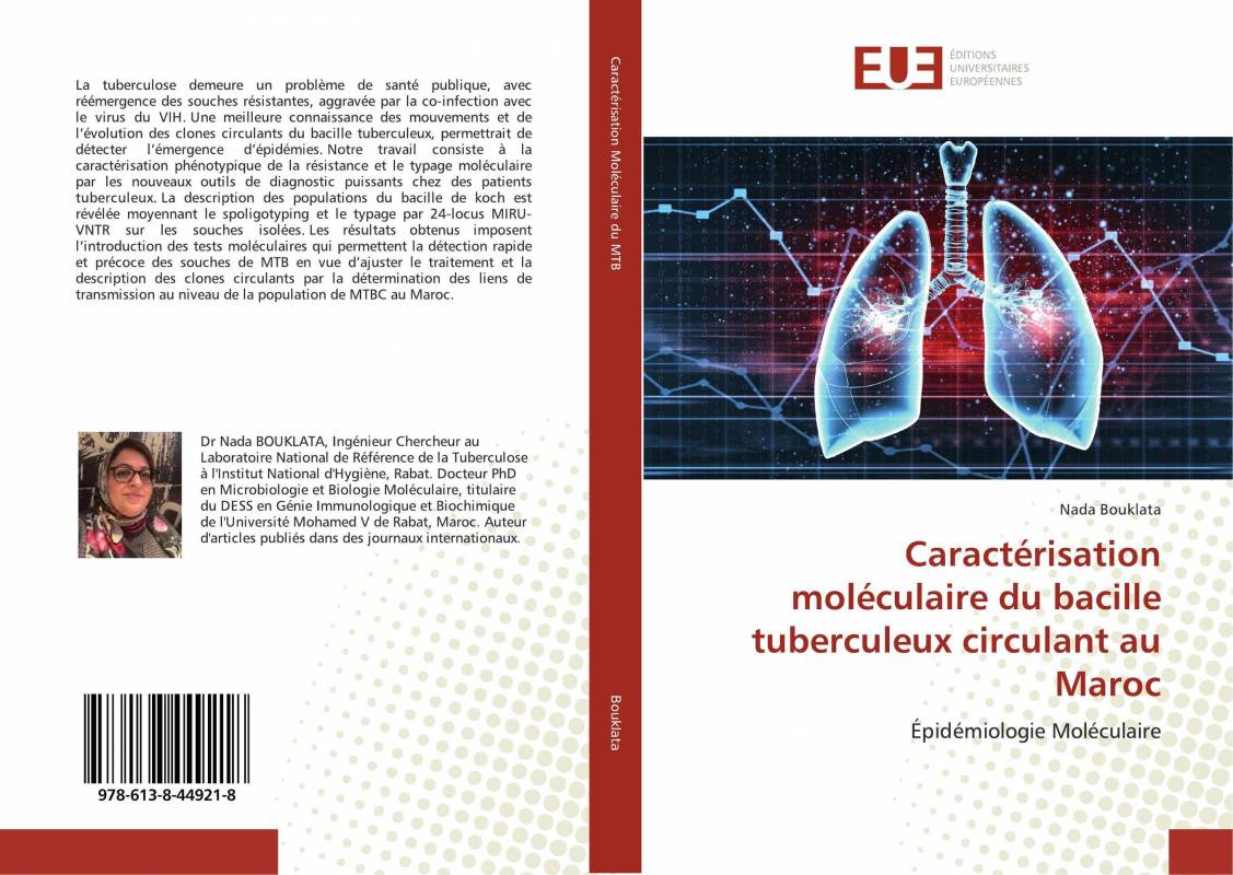 Caractérisation moléculaire du bacille tuberculeux circulant au Maroc