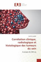 Corrélation clinique, radiologique et histologique des tumeurs du sein