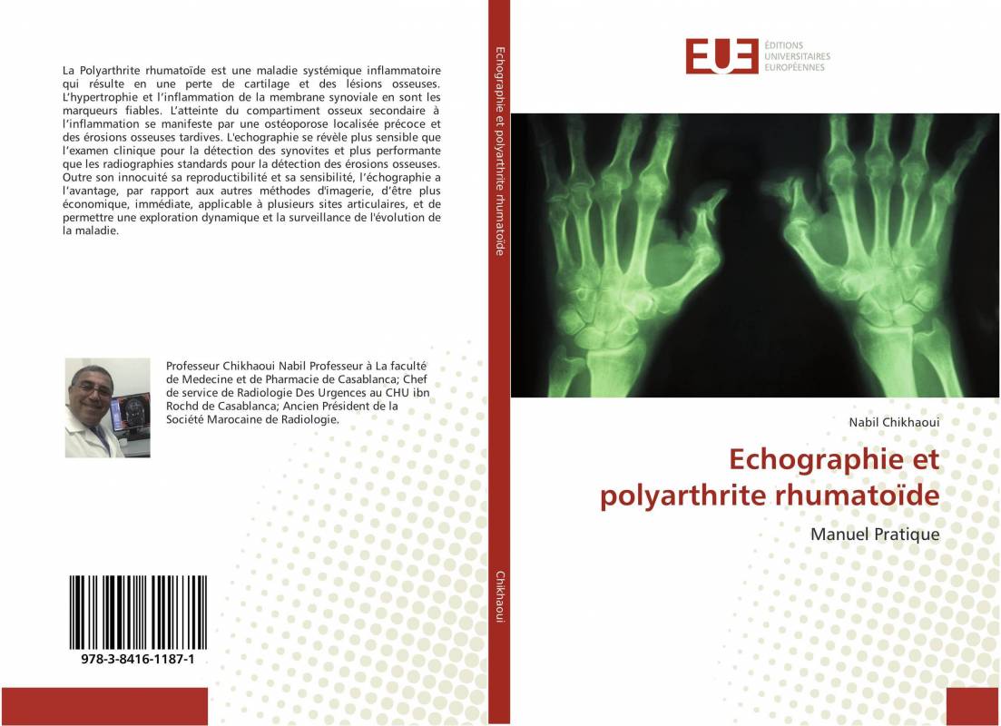 Echographie et polyarthrite rhumatoïde