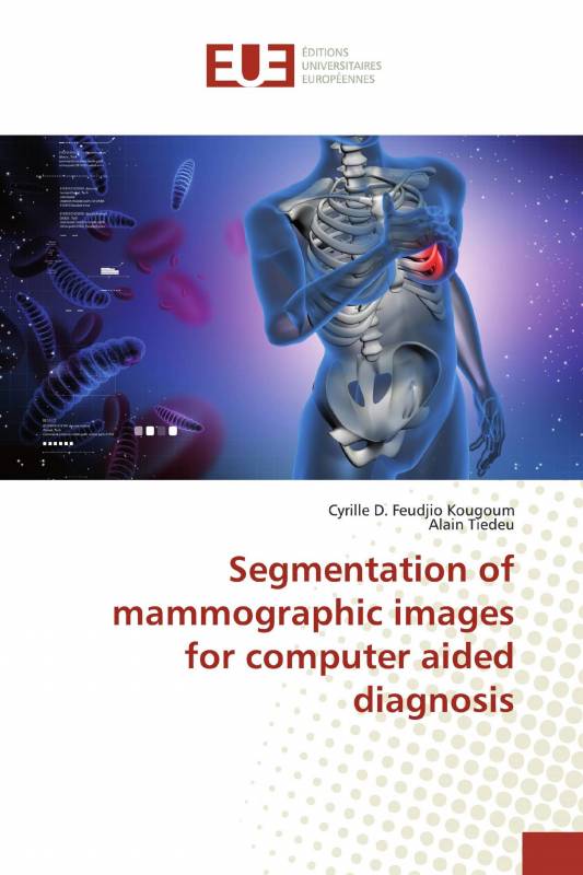 Segmentation of mammographic images for computer aided diagnosis
