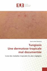 TungiasisUne dermatose tropicale mal documentée