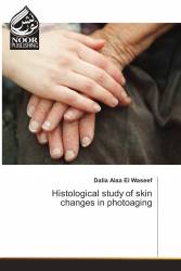 Histological study of skin changes in photoaging
