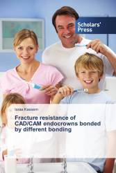Fracture resistance of CAD/CAM endocrowns bonded by different bonding