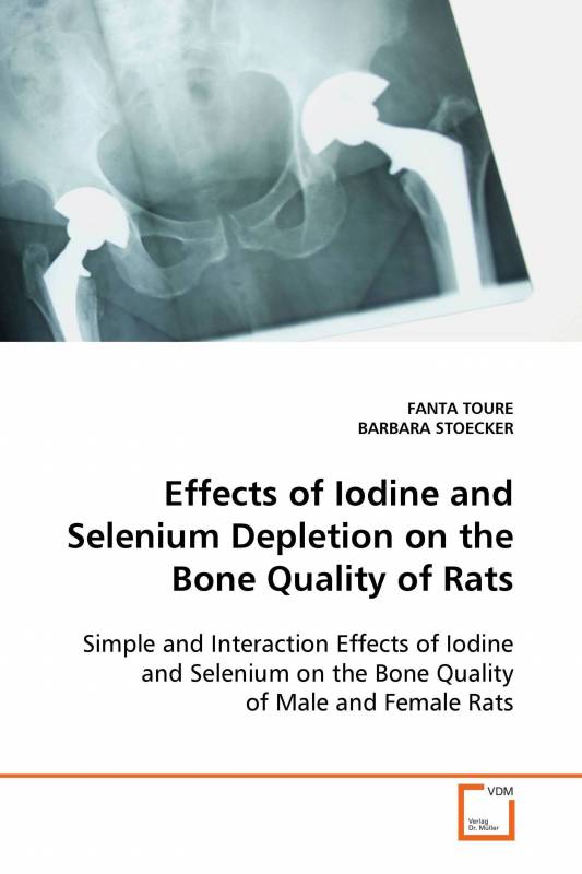 Effects of Iodine and Selenium Depletion on the Bone Quality of Rats