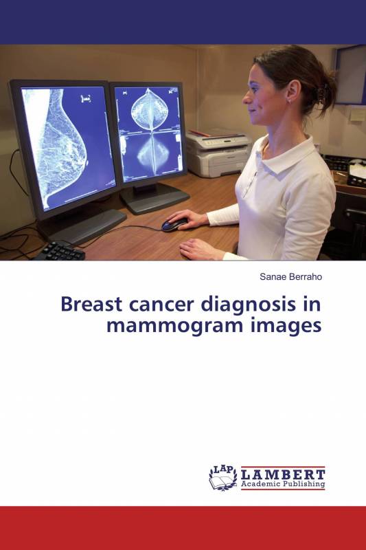 Breast cancer diagnosis in mammogram images