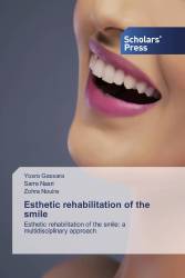 Esthetic rehabilitation of the smile