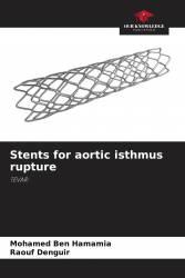 Stents for aortic isthmus rupture