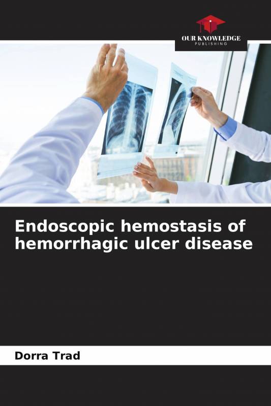Endoscopic hemostasis of hemorrhagic ulcer disease