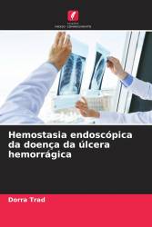 Hemostasia endoscópica da doença da úlcera hemorrágica