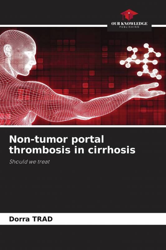 Non-tumor portal thrombosis in cirrhosis