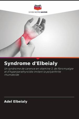 Syndrome d'Elbeialy