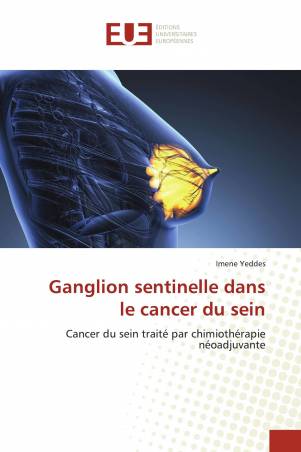Ganglion sentinelle dans le cancer du sein