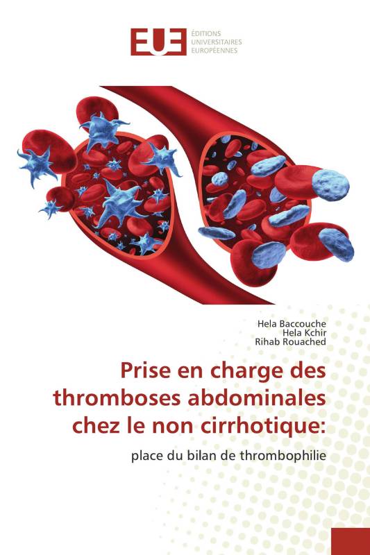 Prise En Charge Des Thromboses Abdominales Chez Le Non Cirrhotique