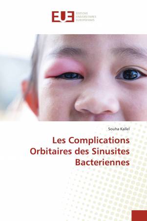 Les Complications Orbitaires des Sinusites Bacteriennes