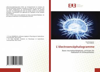 L’électroencéphalogramme