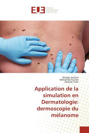 Application de la simulation en Dermatologie: dermoscopie du mélanome