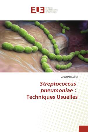 Streptococcus pneumoniae : Techniques Usuelles