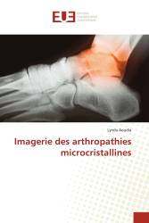 Imagerie des arthropathies microcristallines