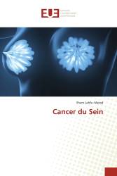 Cancer du Sein