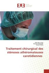 Traitement chirurgical des sténoses athéromateuses carotidiennes