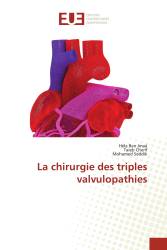 La chirurgie des triples valvulopathies