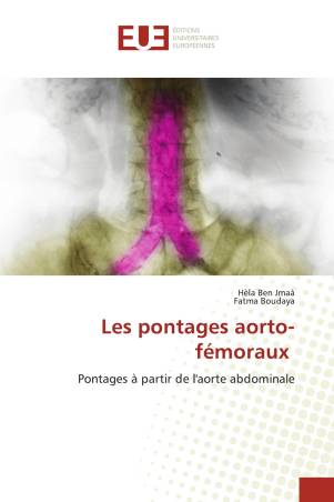 Les pontages aorto-fémoraux