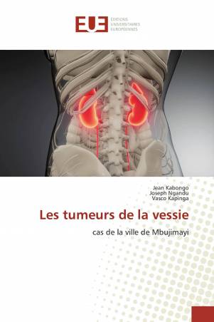 Les tumeurs de la vessie