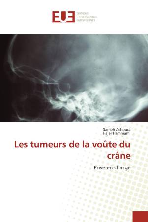 Les tumeurs de la voûte du crâne