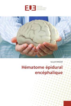 Hématome épidural encéphalique