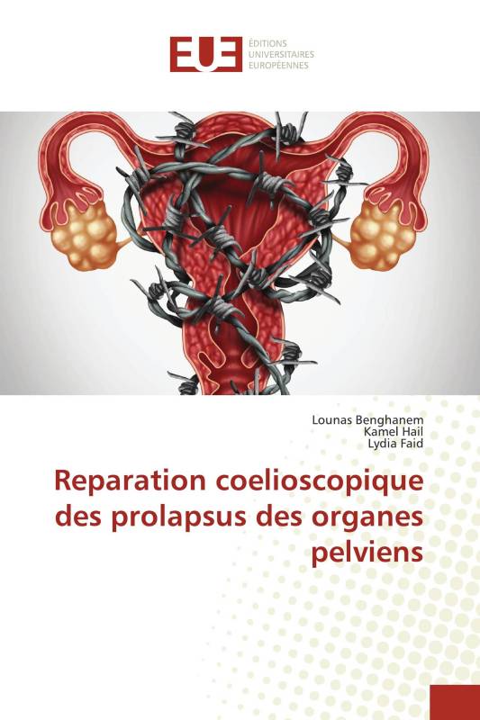 Reparation coelioscopique des prolapsus des organes pelviens