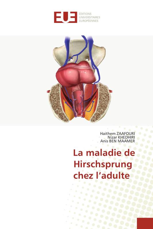 La maladie de Hirschsprung chez l’adulte