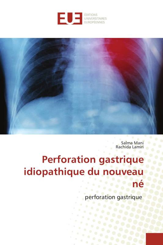 Perforation gastrique idiopathique du nouveau né