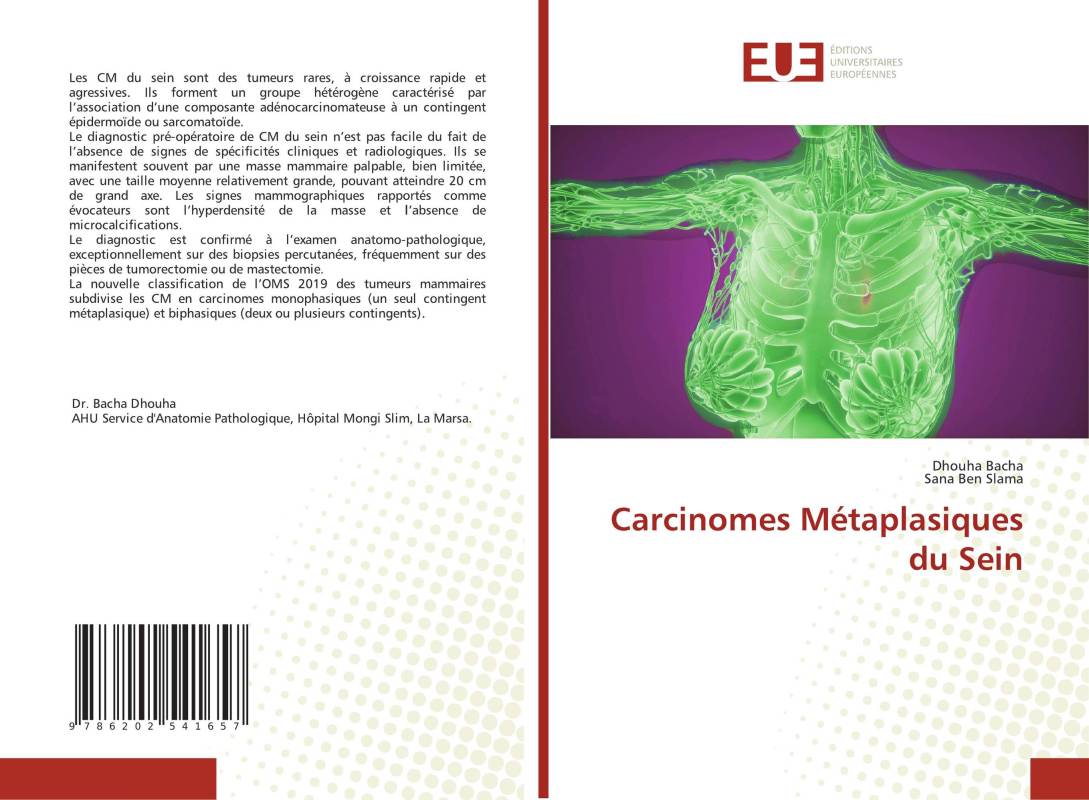 Carcinomes Métaplasiques du Sein