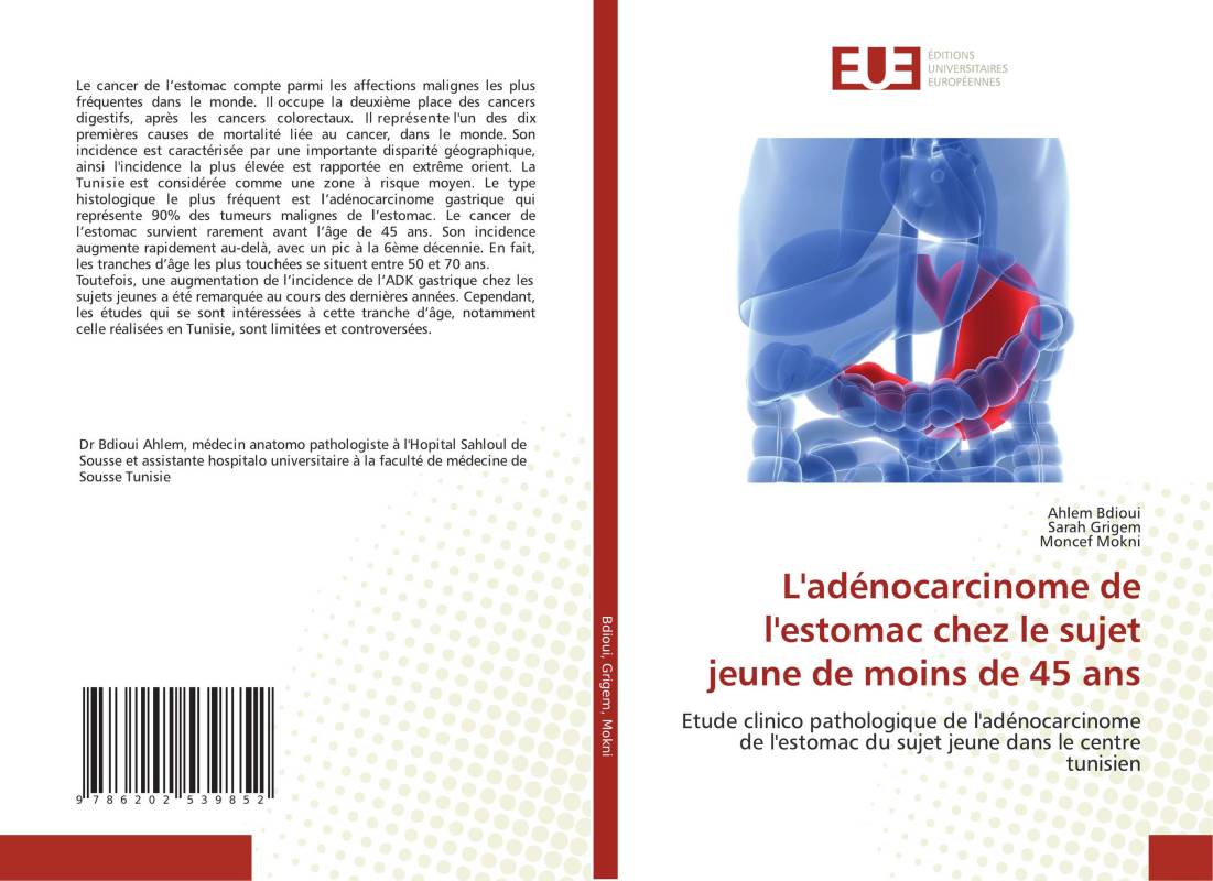 L'adénocarcinome de l'estomac chez le sujet jeune de moins de 45 ans