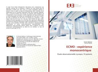 ECMO : expérience monocentrique